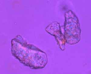 Vista microscópica de maltodextrinas encapsulando moléculas huésped