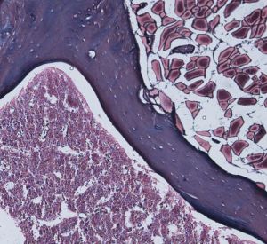 Médula ósea de ratones deficientes en la proteína AIRAPL